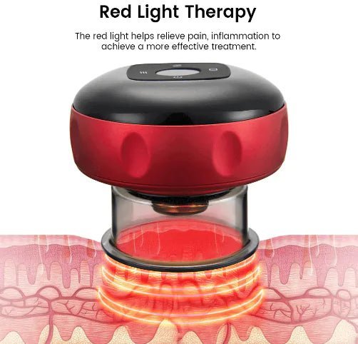 Electric Vacuum Cupping Massager – Relieve Tension & Boost Circulation at Home! - GDNA