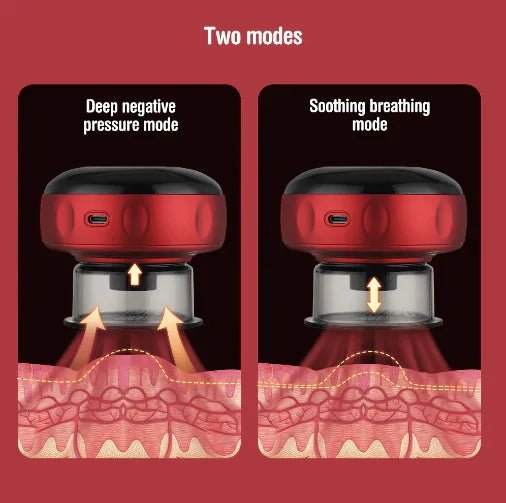 Electric Vacuum Cupping Massager – Relieve Tension & Boost Circulation at Home! - GDNA