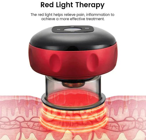 Electric Vacuum Cupping Massager - GDNA